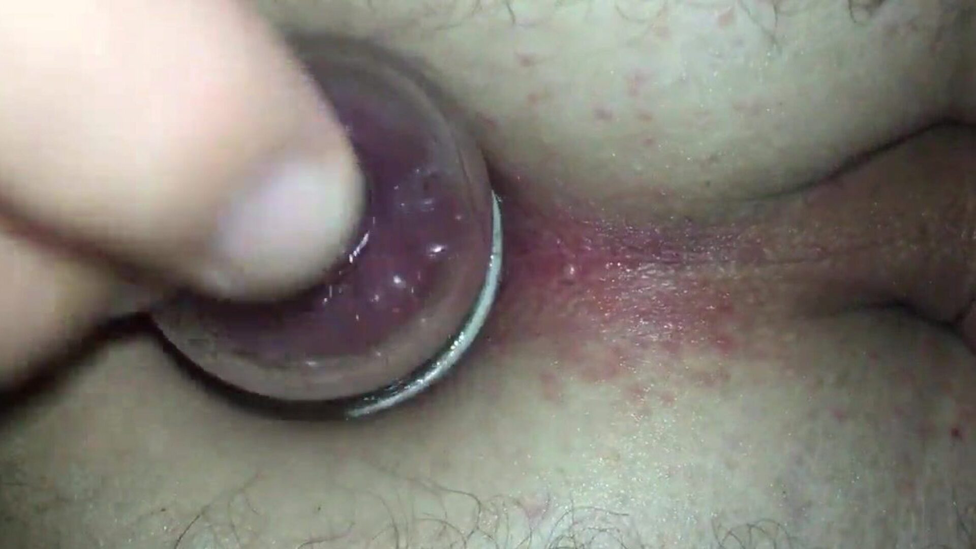 Anus absorption cup and sex toy assfuck poke